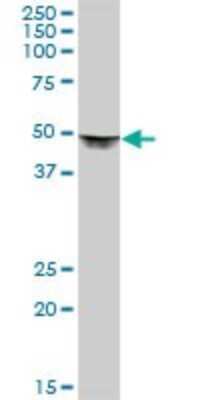 Western Blot: DLST Antibody [H00001743-B01P]