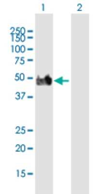 Western Blot: DLST Antibody [H00001743-B01P]