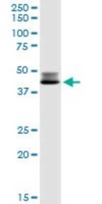 Western Blot: DLST Antibody [H00001743-D01P]