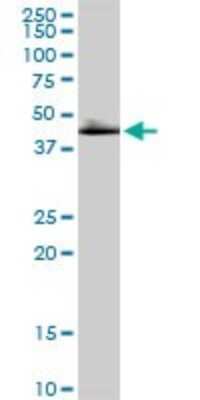 Western Blot: DLST Antibody [H00001743-D01P]