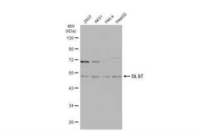 Western Blot: DLST Antibody [NBP1-31715]