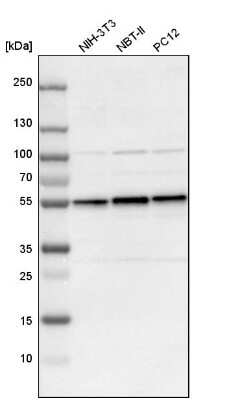 Western Blot: DLST Antibody [NBP1-85012]
