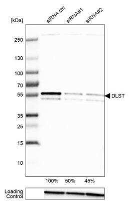 Western Blot: DLST Antibody [NBP1-85012]