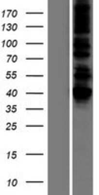 Western Blot: DLST Overexpression Lysate [NBP2-08162]