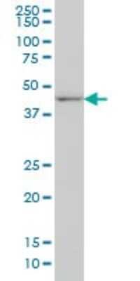 Western Blot: DLX2 Antibody (2B12) [H00001746-M04]