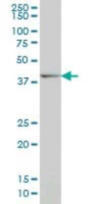 Western Blot: DLX2 Antibody (2C8) [H00001746-M06]