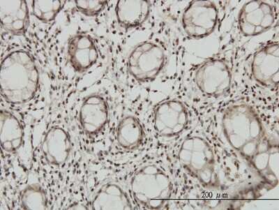 Immunohistochemistry-Paraffin: DLX2 Antibody (2E12) [H00001746-M05]