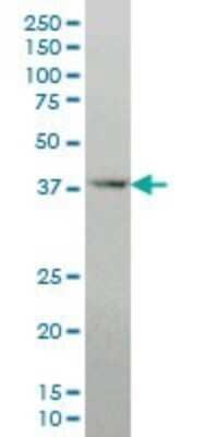 Western Blot: DLX2 Antibody (2E12) [H00001746-M05]