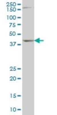 Western Blot: DLX2 Antibody (2H2) [H00001746-M01]