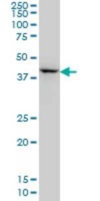 Western Blot: DLX2 Antibody (4B9) [H00001746-M02]