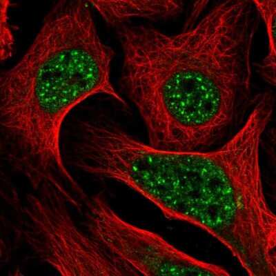 Immunocytochemistry/ Immunofluorescence: DLX2 Antibody [NBP2-54963]