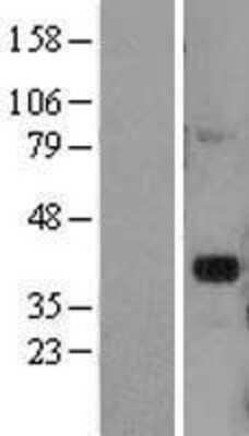 Western Blot: DLX2 Overexpression Lysate [NBL1-09917]