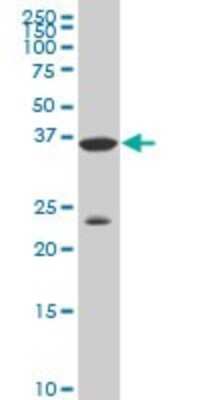 Western Blot: DLX3 Antibody (3B8) [H00001747-M02]