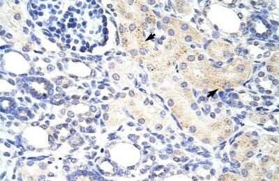 Immunohistochemistry: DLX3 Antibody [NBP2-88802]