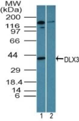 Western Blot: DLX3 Antibody [NBP2-24646]