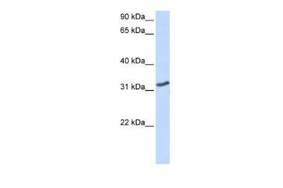 Western Blot: DLX3 Antibody [NBP2-88801]