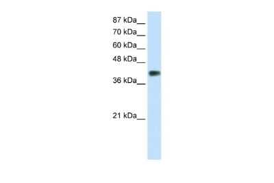 Western Blot: DLX3 Antibody [NBP2-88803]