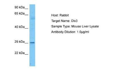 Western Blot: DLX3 Antibody [NBP2-88803]