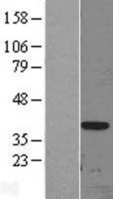 Western Blot: DLX3 Overexpression Lysate [NBL1-09918]