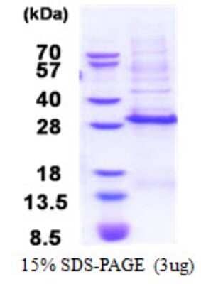 SDS-PAGE: Recombinant Human DLX3 His Protein [NBP2-23004]