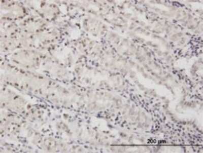 Immunohistochemistry-Paraffin: DLX5 Antibody (1B7) [H00001749-M02]