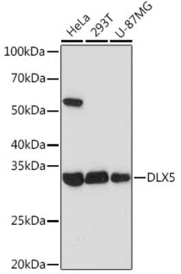 Western Blot: DLX5 Antibody (2F9C6) [NBP3-16605]