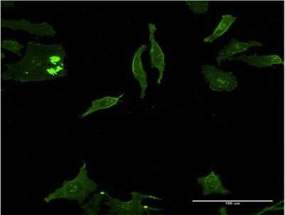 Immunocytochemistry/ Immunofluorescence: DLX5 Antibody (3B11) [H00001749-M12]