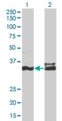 Western Blot: DLX5 Antibody (3B11) [H00001749-M12]