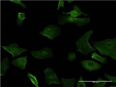 Immunocytochemistry/ Immunofluorescence: DLX5 Antibody (4C6) [H00001749-M09]