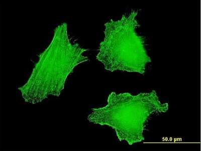 Immunocytochemistry/ Immunofluorescence: DLX5 Antibody (4H6) [H00001749-M07]