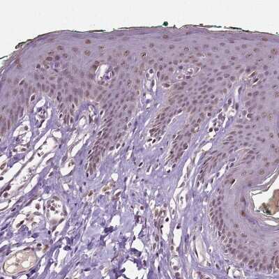 Immunohistochemistry-Paraffin: DLX5 Antibody [NBP1-85793]