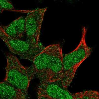 Immunocytochemistry/ Immunofluorescence: DMAP1 Antibody [NBP2-55093]