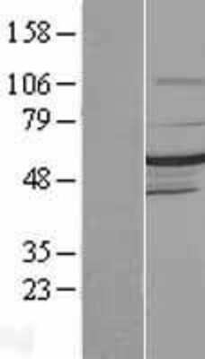 Western Blot: DMAP1 Overexpression Lysate [NBL1-09922]