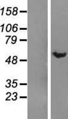 Western Blot: DMAP1 Overexpression Lysate [NBL1-09923]