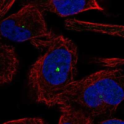 Immunocytochemistry/ Immunofluorescence: DMBT1/GP340 Antibody [NBP2-38471]