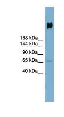 Western Blot: DMBT1/GP340 Antibody [NBP1-57668]