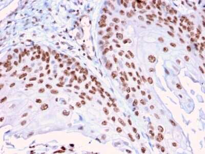 Immunohistochemistry-Paraffin: DMC1 Antibody (2H12/4) [NBP3-07507]