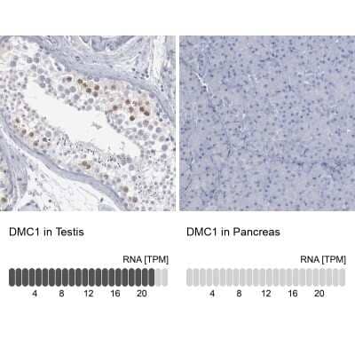 Immunohistochemistry-Paraffin: DMC1 Antibody [NBP1-82838]