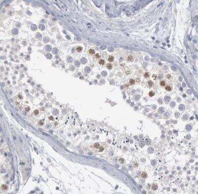Immunohistochemistry-Paraffin: DMC1 Antibody [NBP1-82838]