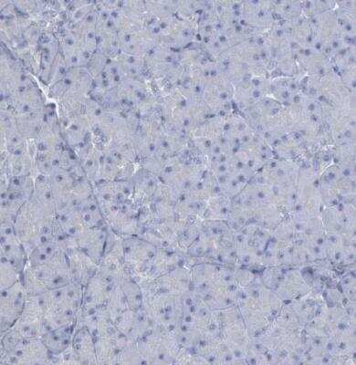 Immunohistochemistry-Paraffin: DMC1 Antibody [NBP1-82838]