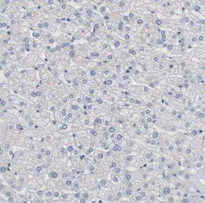 Immunohistochemistry-Paraffin: DMC1 Antibody [NBP1-82838]