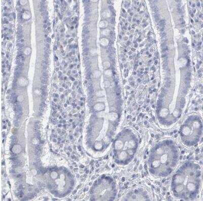Immunohistochemistry-Paraffin: DMC1 Antibody [NBP1-82838]