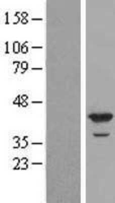 Western Blot: DMC1 Overexpression Lysate [NBP2-07532]