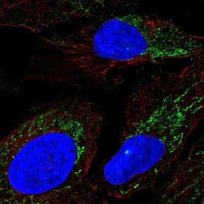 Immunocytochemistry/ Immunofluorescence: DMGDH Antibody [NBP2-58017]