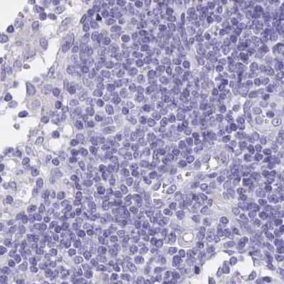 Immunohistochemistry-Paraffin: DMGDH Antibody [NBP1-86289]