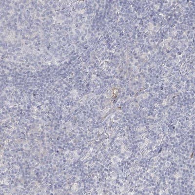 Immunohistochemistry-Paraffin: DMGDH Antibody [NBP2-32666]