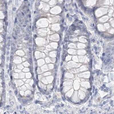 Immunohistochemistry-Paraffin: DMGDH Antibody [NBP2-32666]