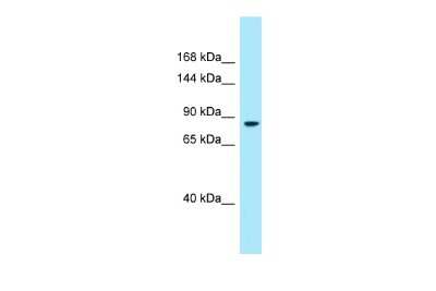 Western Blot: DMGDH Antibody [NBP2-87278]