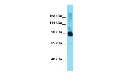 Western Blot: DMGDH Antibody [NBP2-87279]