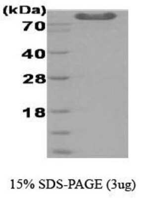 SDS-PAGE: Recombinant Arthrobacter globiformis DMGO His Protein [NBC1-18524]